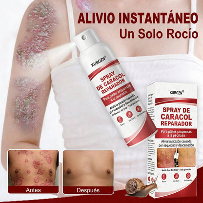 KUBOZN® 🎉SPRAY DE CADACOL REPARADOR  Para piel con psoriasis, con picazón y descamación💗