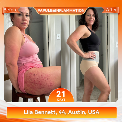🔥 𝐎𝐟𝐟𝐢𝐜𝐢𝐚𝐥 𝐁𝐫𝐚𝐧𝐝 𝐒𝐭𝐨𝐫𝐞 🔥 | 𝐏𝐀𝐔𝐑𝐀𝐉𝐔® 𝟐𝟎𝟐𝟔 𝐌𝐨𝐫𝐢𝐧𝐠𝐚 & 𝐁𝐞𝐫𝐛𝐞𝐫𝐢𝐧𝐞 𝟒-𝐈𝐧-𝟏 𝐌𝐢𝐜𝐫𝐨-𝐏𝐚𝐫𝐭𝐢𝐜𝐥𝐞 𝐒𝐜𝐮𝐥𝐩𝐭𝐢𝐧𝐠 & 𝐅𝐚𝐭-𝐁𝐮𝐫𝐧 𝐒𝐡𝐨𝐫𝐭𝐬 🎉