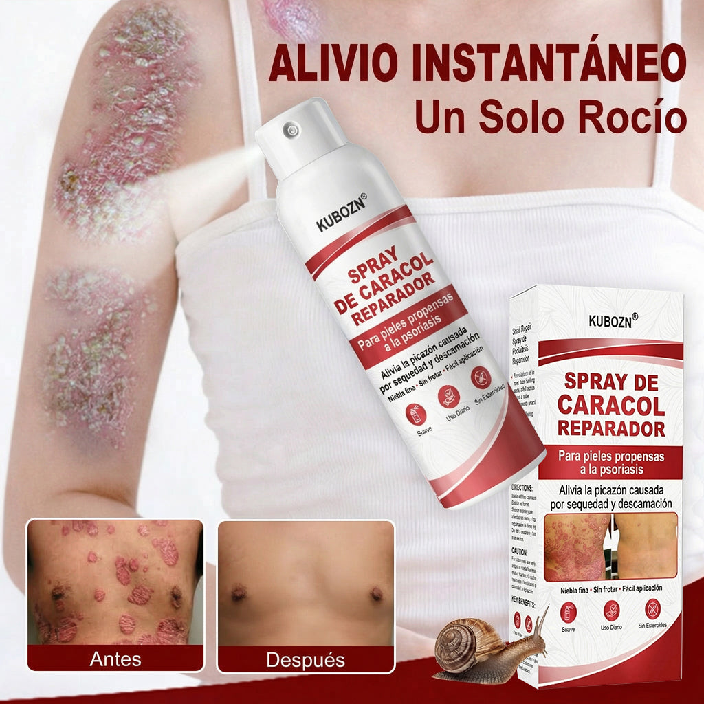 KUBOZN® 🎉SPRAY DE CADACOL REPARADOR  Para piel con psoriasis, con picazón y descamación🚑