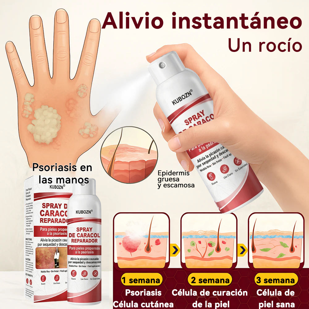 KUBOZN® 🎉SPRAY DE CADACOL REPARADOR  Para piel con psoriasis, con picazón y descamación💗