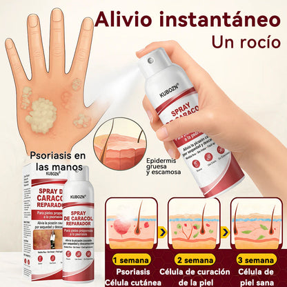 KUBOZN® 🎉SPRAY DE CADACOL REPARADOR  Para piel con psoriasis, con picazón y descamación🚑