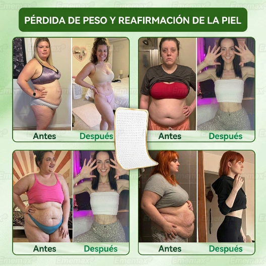 🟥[[𝐍𝐨𝐯𝐞𝐝𝐚𝐝 𝐲 𝐦𝐞𝐣𝐨𝐫𝐚 𝟐𝟎𝟐𝟔: ¡𝟖𝟎% 𝐝𝐞 𝐝𝐞𝐬𝐜𝐮𝐞𝐧𝐭𝐨!] ✅ 𝐄𝐦𝐞𝐦𝐚𝐱®𝐏𝐀𝐑𝐂𝐇𝐄 𝐍𝐀𝐍𝐎 𝐌𝐈𝐂𝐑𝐎𝐍𝐄𝐄𝐃𝐋𝐄 𝐀𝐃𝐄𝐋𝐆𝐀𝐙𝐀𝐍𝐓𝐄 𝐃𝐑𝐄𝐍𝐀𝐉𝐄 𝐋𝐈𝐍𝐅𝐀𝐓𝐈𝐂𝐎 — 𝐀𝐝𝐞𝐦á𝐬: 𝐚𝐥𝐢𝐯𝐢𝐨 𝐚𝐫𝐭𝐢𝐜𝐮𝐥𝐚𝐫, 𝐦𝐞𝐣𝐨𝐫 𝐝𝐞𝐬𝐜𝐚𝐧𝐬𝐨 𝐲 𝐜𝐥𝐚𝐫𝐢𝐝𝐚𝐝 𝐦𝐞𝐧𝐭𝐚𝐥.🧀