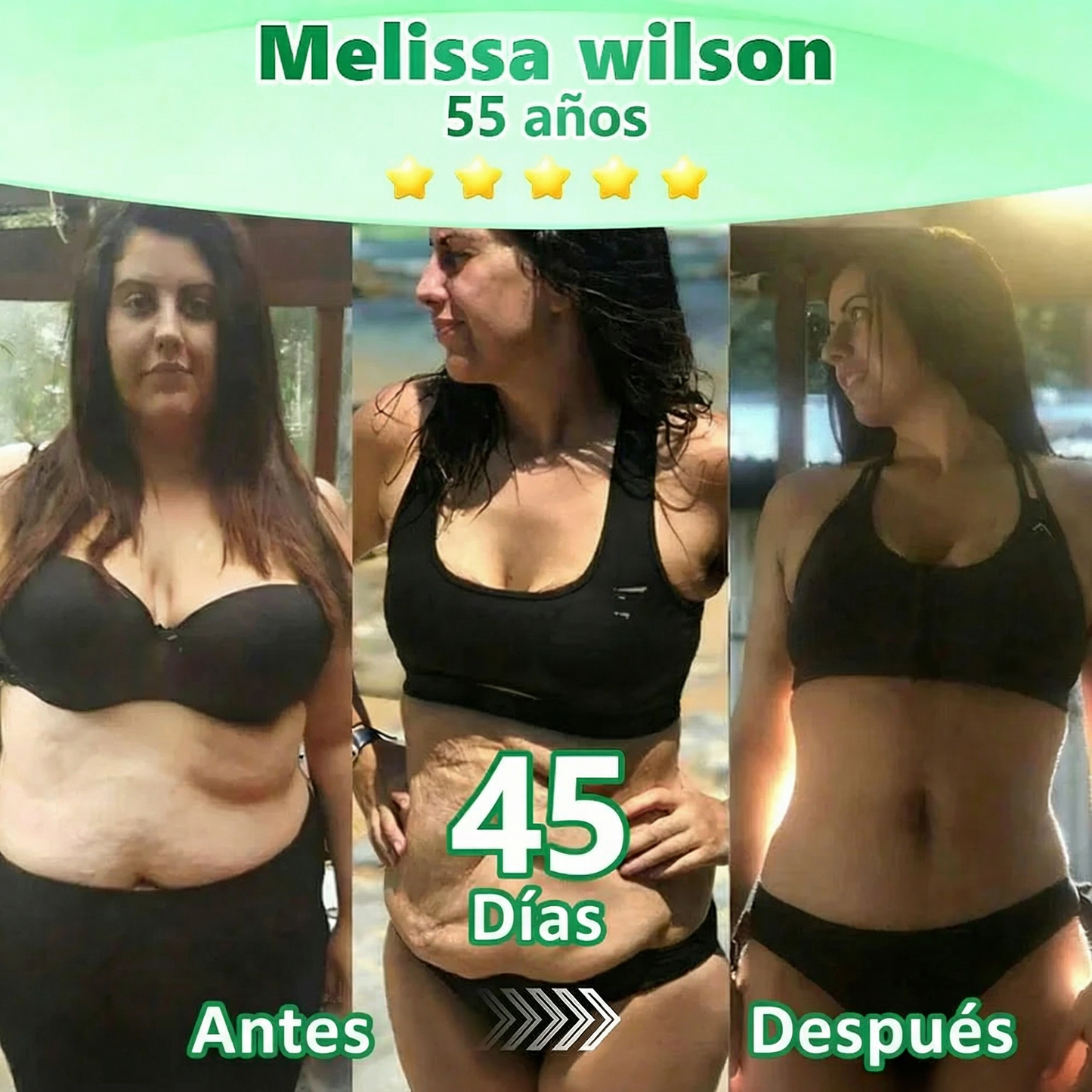 Pago contra entrega [70 % de descuento] Florisma® 👩‍⚕️ Parches microagujeros premium 10 en 1 con moringa y berberina. Indicados para la obesidad, la diabetes, la apnea del sueño y los problemas articulares😽